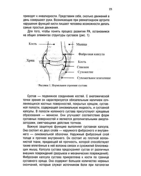 Ревматоидный артрит. Ч. 1: Современные представления о диогностике, лечении, профилактике