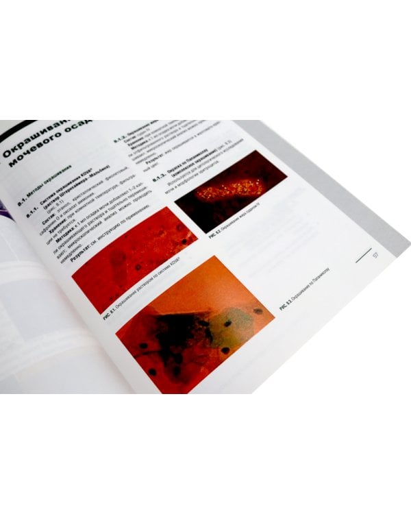 Биохимия. Основные метаболические пути организма человека (38 карточек). Анализ осадка мочи (комплект из 2-х книг)