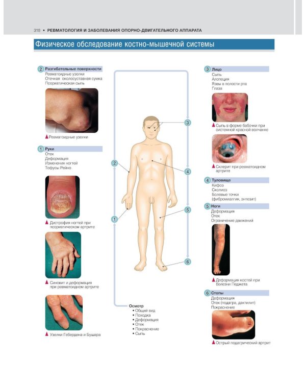 Внутренние болезни по Дэвидсону: В 5 т. Т. 1. Кардиология. Пульмонология. Ревматология и забол-я опорно-двигат-го аппарата. Нефрология и урология. 2-е