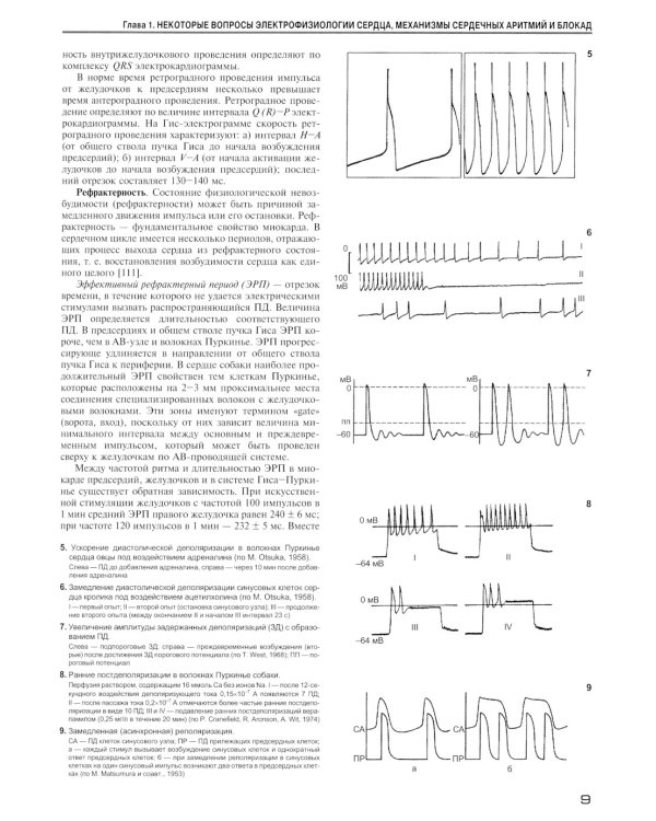 Аритмии и блокады сердца: атлас электрокардиограмм. 5-е изд., перераб. и доп