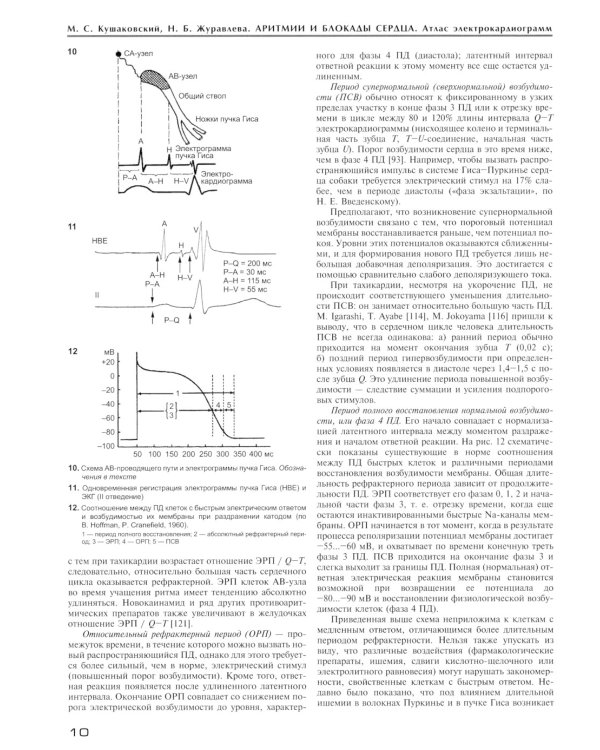 Аритмии и блокады сердца: атлас электрокардиограмм. 5-е изд., перераб. и доп