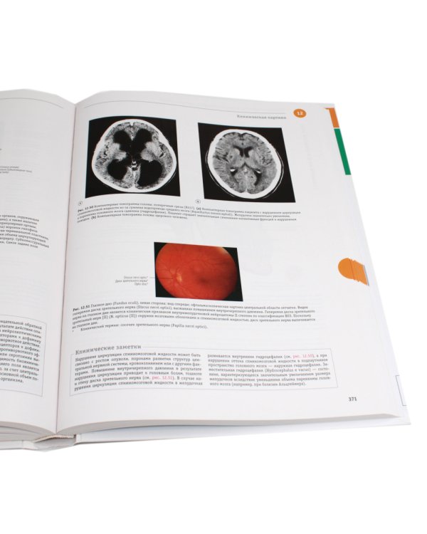 Sobotta. Атлас анатомии человека. В 3 т (комплект из 3-х книг)