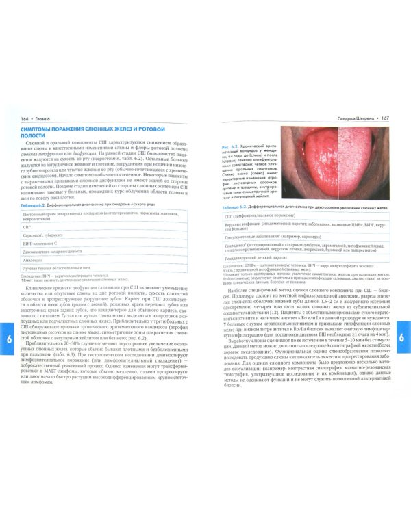 Ревматические заболевания. В 3-х томах. Том 3. Заболевания мягких тканей. Руководство