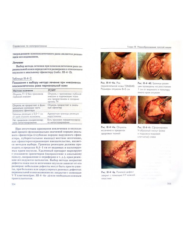 Справочник по колопроктологии