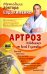 Артроз. Избавляемся от болей в суставах