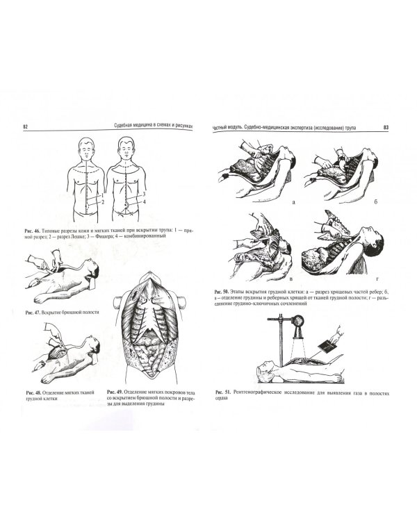 Судебная медицина в схемах и рисунках. Учебное пособие