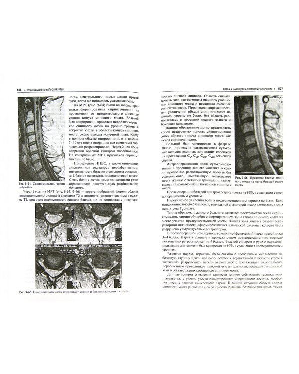 Нейрохирургия. Лекции, семинары, клинические работы. В 2-х томах. Том 2