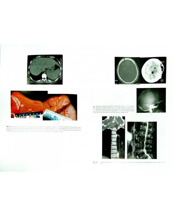 Гематология. Национальное руководство