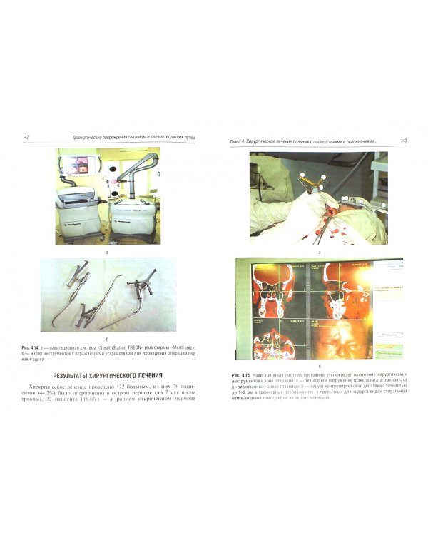 Травматические повреждения глазницы и слезоотводящих путей