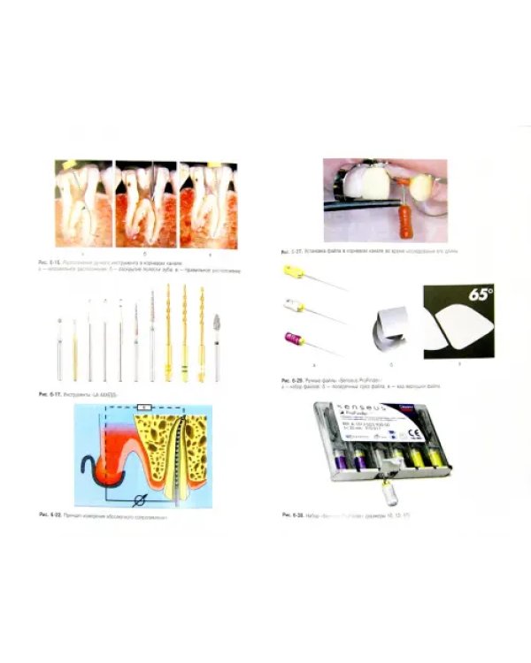 Терапевтическая стоматология. Национальное руководство