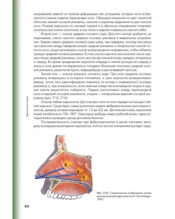 Эндоскопическая диагностика и лечение назальной ликвореи