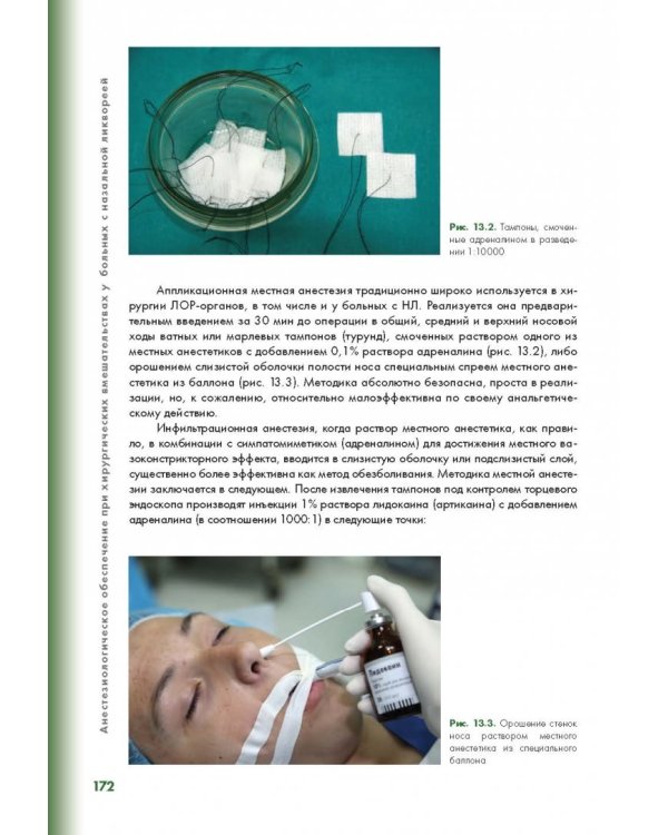 Эндоскопическая диагностика и лечение назальной ликвореи