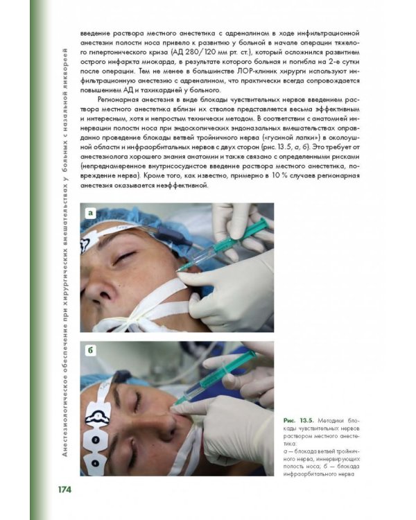 Эндоскопическая диагностика и лечение назальной ликвореи