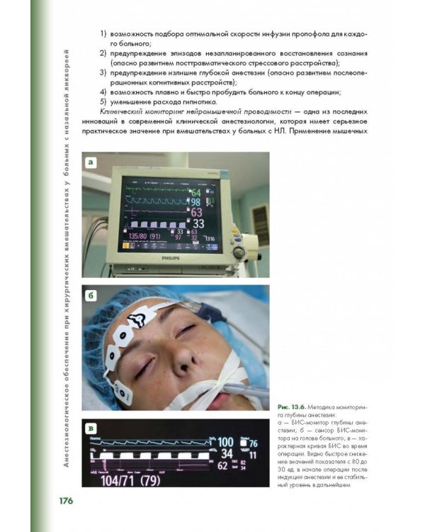 Эндоскопическая диагностика и лечение назальной ликвореи