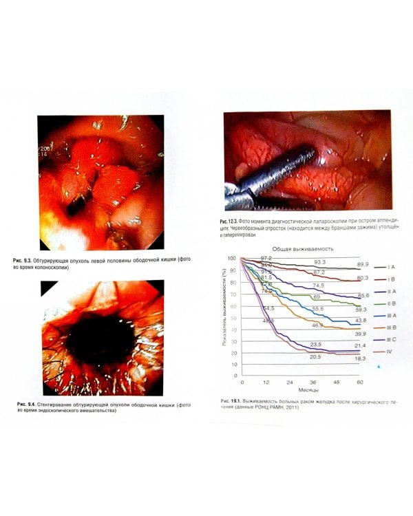 Абдоминальная хирургия. Национальное руководство. Краткое издание