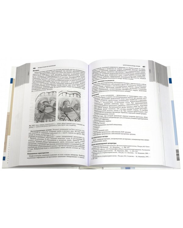 Оториноларингология. Национальное руководство