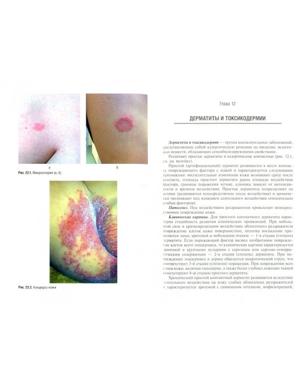 Физиотерапия в дерматологии