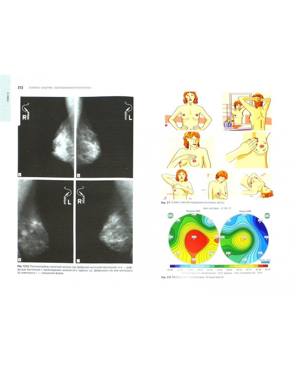 Маммология. Национальное руководство