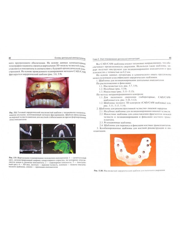 Основы дентальной имплантологии. Учебное пособие. Гриф МО РФ