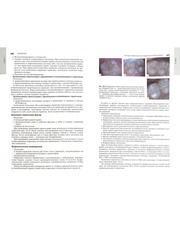 Детская терапевтическая стоматология. Национальное руководство