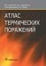 Атлас термических поражений