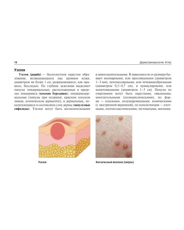 Дерматовенерология. Атлас