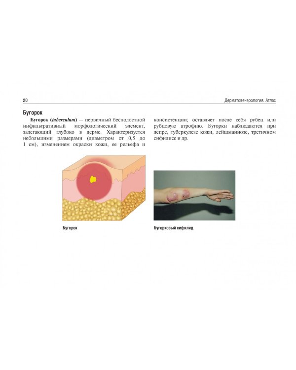 Дерматовенерология. Атлас