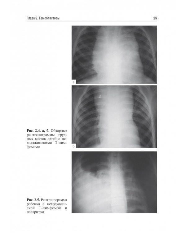 Детская онкология. Учебник для ВУЗов