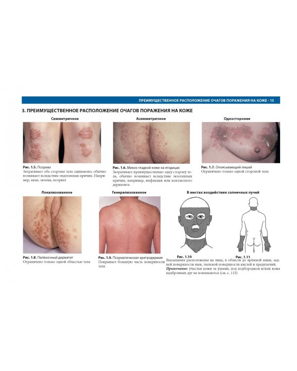 Дифференциальная диагностика в дерматологии. Атлас