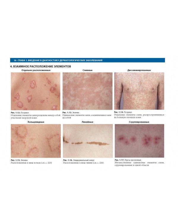 Дифференциальная диагностика в дерматологии. Атлас