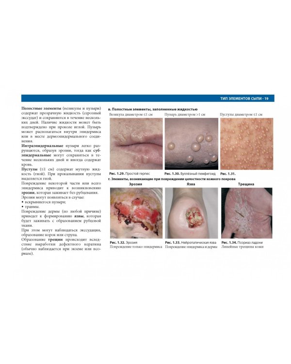 Дифференциальная диагностика в дерматологии. Атлас