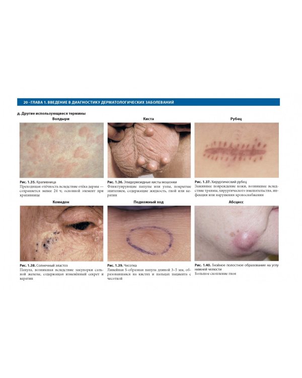 Дифференциальная диагностика в дерматологии. Атлас