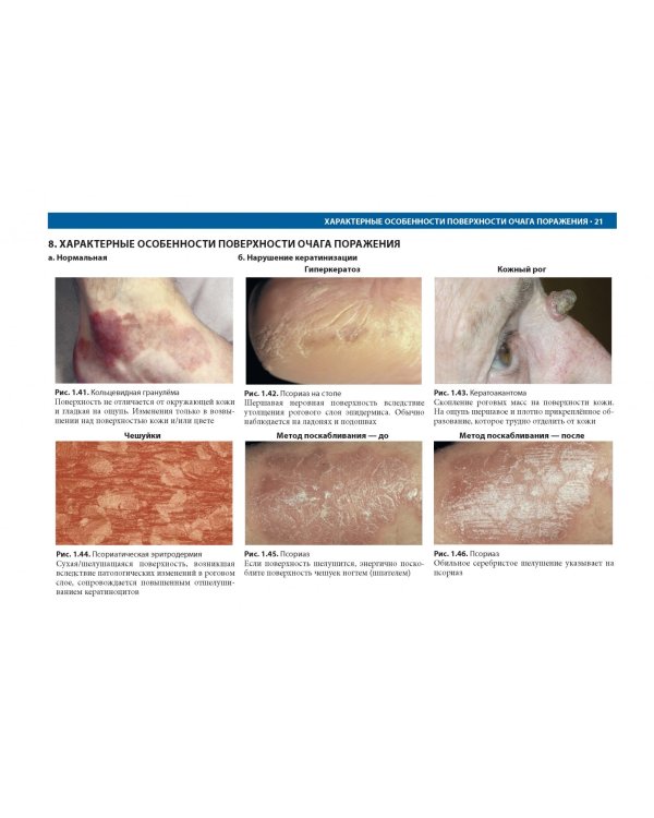 Дифференциальная диагностика в дерматологии. Атлас