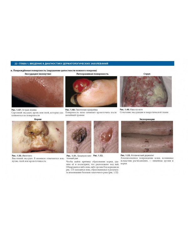 Дифференциальная диагностика в дерматологии. Атлас
