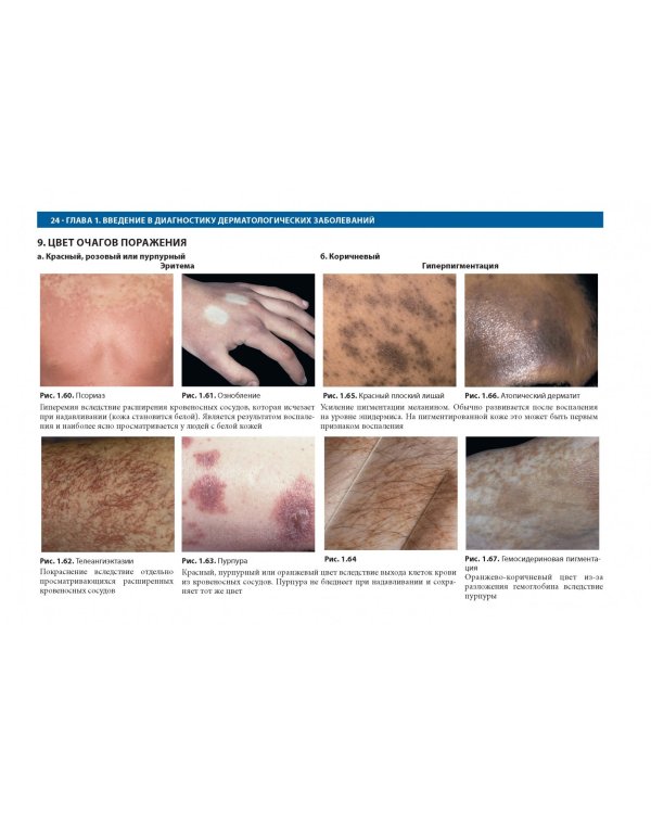 Дифференциальная диагностика в дерматологии. Атлас
