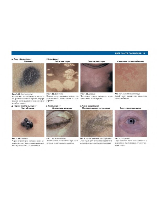 Дифференциальная диагностика в дерматологии. Атлас