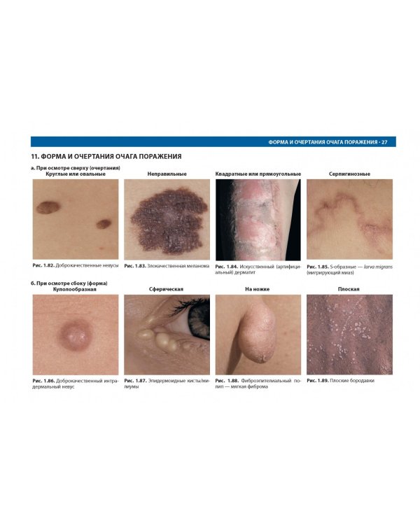 Дифференциальная диагностика в дерматологии. Атлас