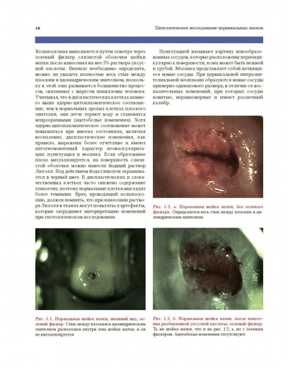 Цитологическое исследование цервикальных мазков. Атлас