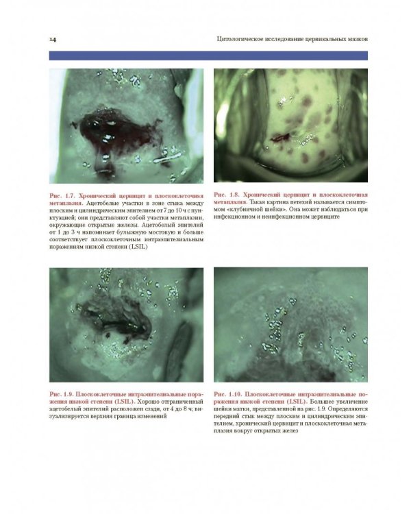 Цитологическое исследование цервикальных мазков. Атлас