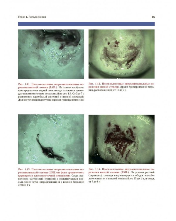 Цитологическое исследование цервикальных мазков. Атлас