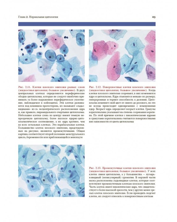 Цитологическое исследование цервикальных мазков. Атлас