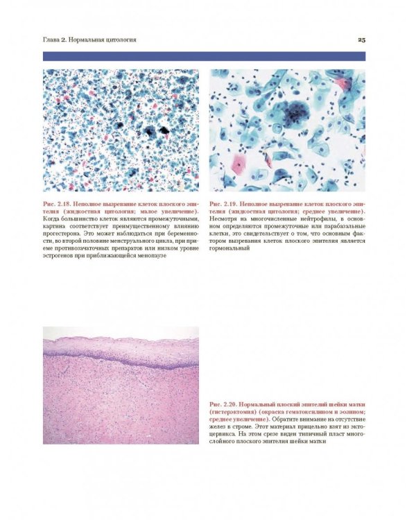 Цитологическое исследование цервикальных мазков. Атлас