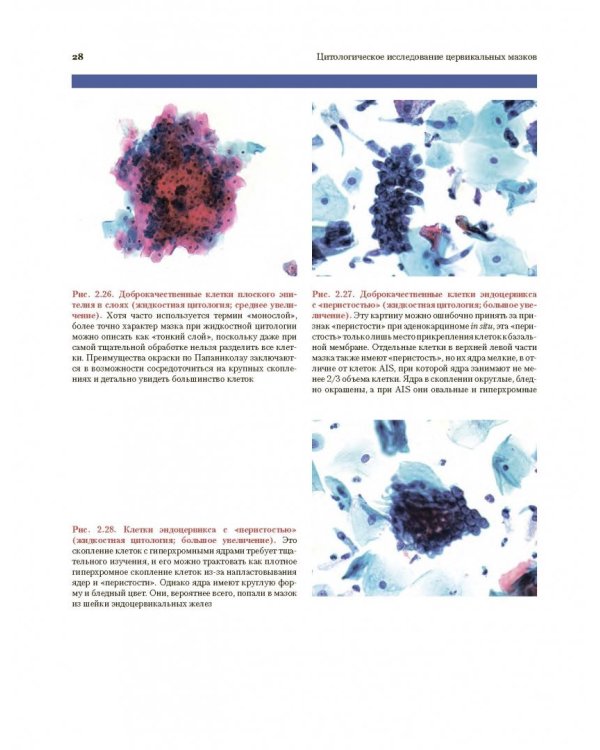 Цитологическое исследование цервикальных мазков. Атлас