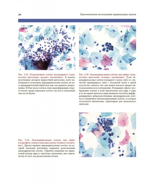 Цитологическое исследование цервикальных мазков. Атлас