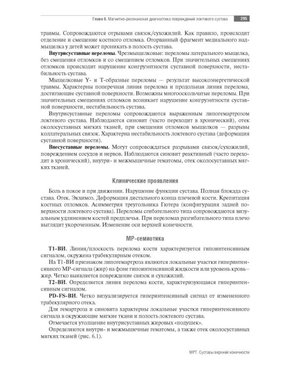 МРТ. Суставы верхней конечности. Руководство для врачей