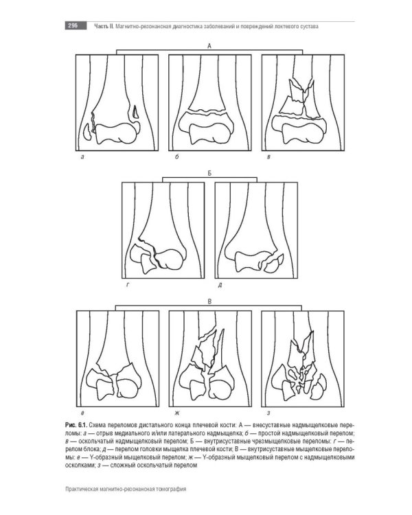 МРТ. Суставы верхней конечности. Руководство для врачей