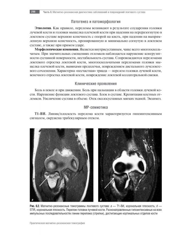 МРТ. Суставы верхней конечности. Руководство для врачей