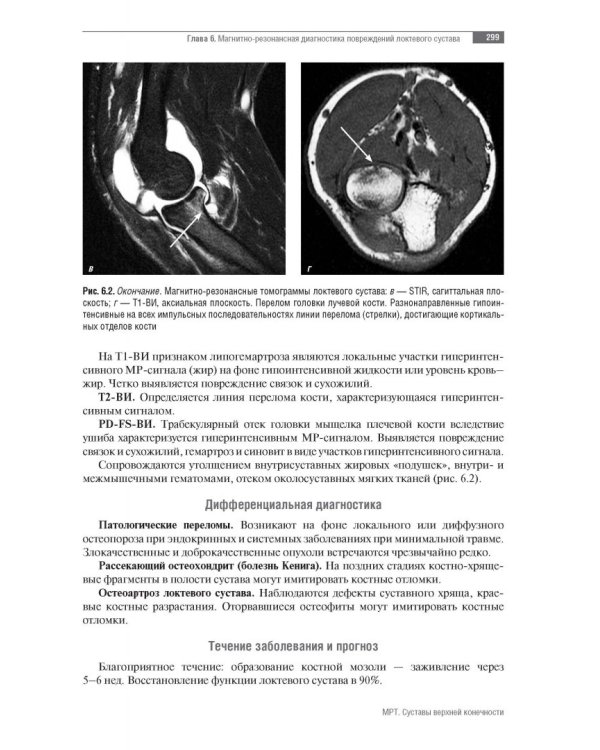 МРТ. Суставы верхней конечности. Руководство для врачей