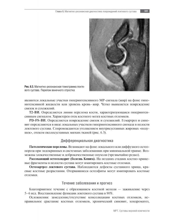 МРТ. Суставы верхней конечности. Руководство для врачей