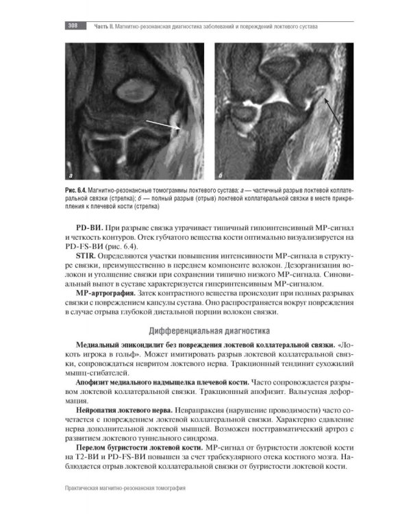 МРТ. Суставы верхней конечности. Руководство для врачей